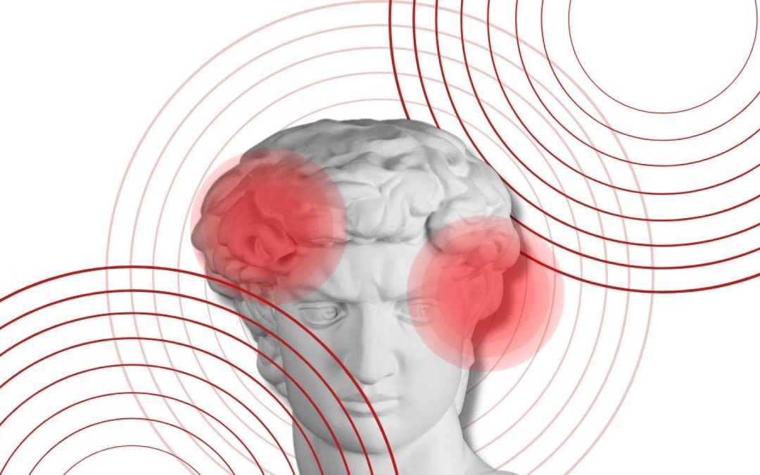 La migraña es un problema de salud pública