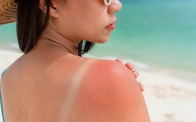 No sea víctima del foto envejecimiento Recuerde que los rayos ultravioleta pueden ser implacables con la piel Algunos consejos de protección y cuidado